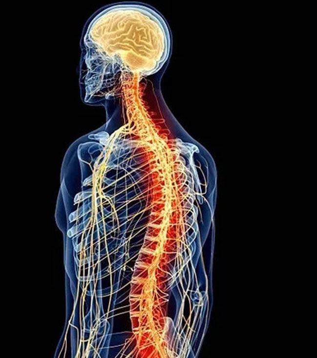 Neurological Conditions